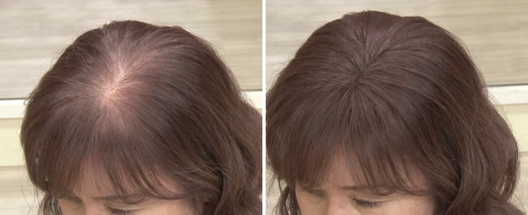 Load video: Conceal Thinning Hair and grey coverage